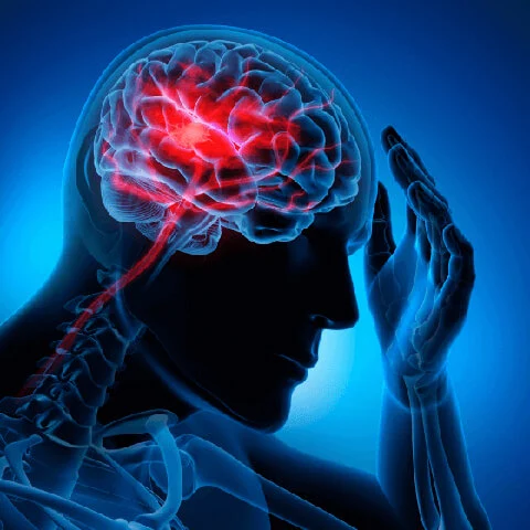 Prevent Stroke